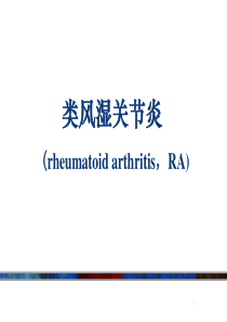 类风湿关节炎(含各种评分标准)