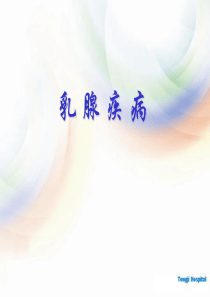 82乳腺疾病课件