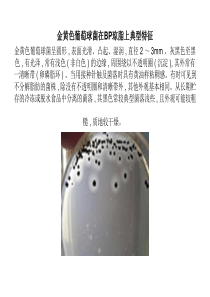 菌落在培养基上的典型特征