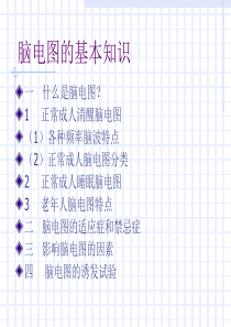 脑电图的基本知识