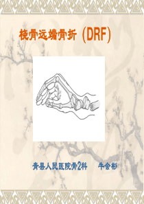 9桡骨远端骨折