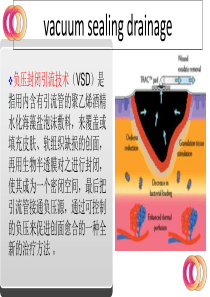 最新：vsd护理查房-文档资料