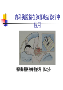 内科胸腔镜
