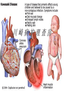 川崎病的护理查房