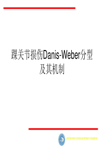 踝关节损伤Danis-Weber分型及其机制