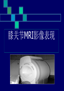 膝关节MRI