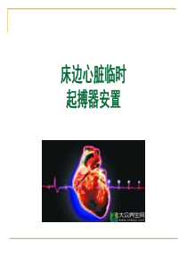 临时起起搏器植入术