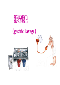 基础护理学之洗胃法PPT