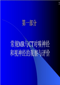 各条颅神经清晰MRI影像
