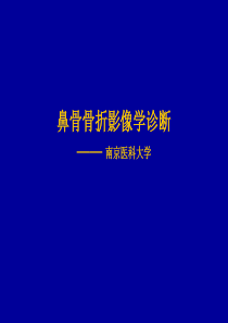 鼻骨骨折的影像诊断