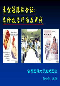 ACS急诊指南与实践201305