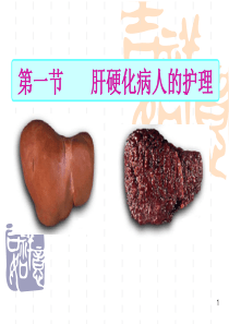 肝硬化病人的护理-自考课件新修改