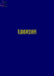 乳腺癌典型病例讨论一例