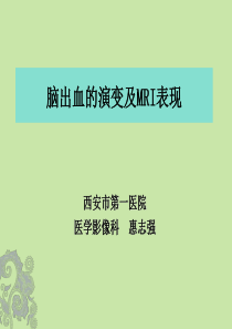 脑内血肿的分期及MRI表现