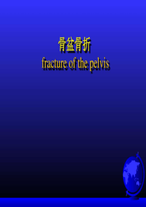 骨盆骨折_临床医学_医药卫生_专业资料.ppt
