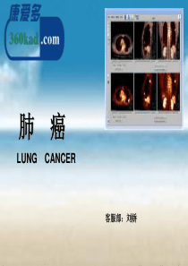 肺癌专业知识