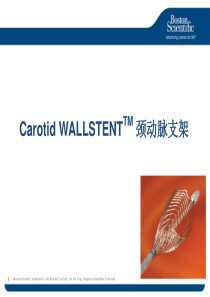 颈动脉产品介绍 - 支架-in service