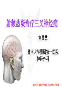 三叉神经痛刘灵慧