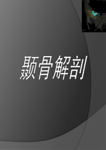 颞骨大体解剖及CT解剖