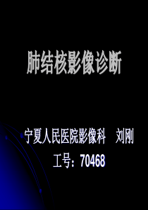 肺结核影像诊断ppt课件