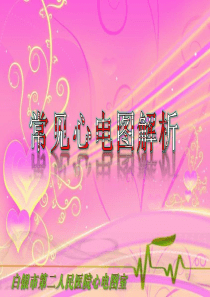 常见心电图解析