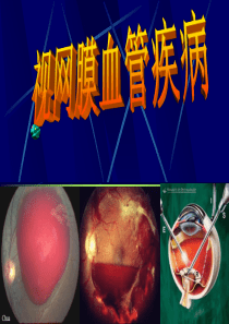 视网膜血管疾病