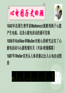 心电图-基础知识