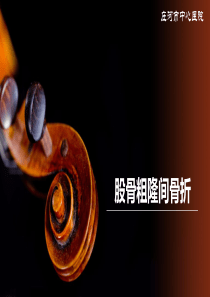股骨粗隆间骨折