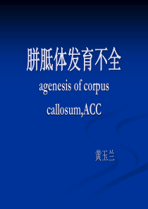 胼胝体发育不全