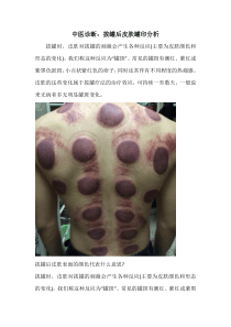 中医诊断：拔罐后皮肤罐印分析