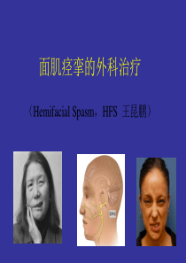 面肌痉挛