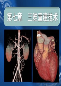 医学成像技术(第八章_三维重建技术)