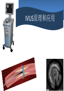 血管内超声IVUS原理和应用