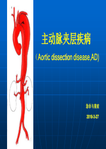 11主动脉夹层ppt