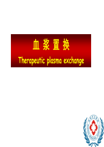 血浆置换