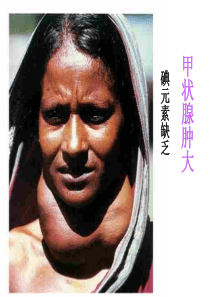 初三化学下学期化学元素与人体健康
