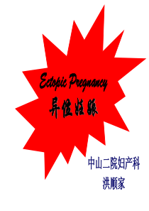 异位妊娠课件