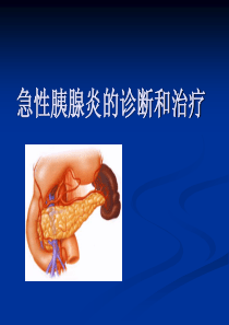 急性胰腺炎的诊断和治疗