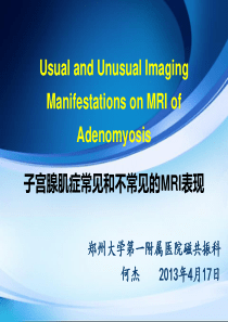 子宫腺肌症常见和不常见的MRI表现-影像FTP