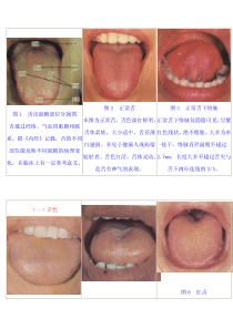 舌诊图集附详解