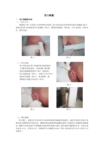 伤口测量解析