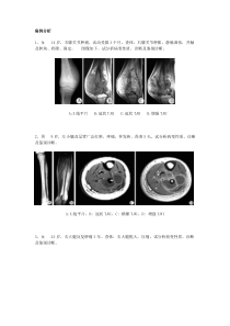 医学影像学病例分析