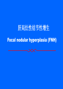 fnh肝局灶性结节性增生.