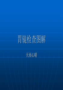 胃镜检查图解