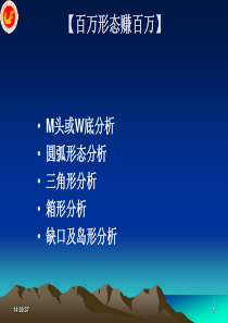 L-股票形态