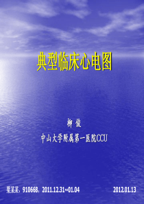 急性右室下壁后壁心肌梗死心电图1例