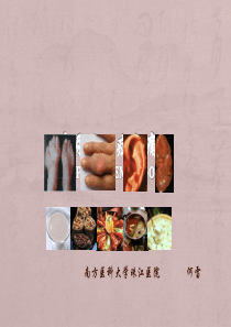 痛风课件PPT课件