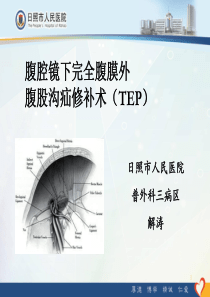 腹腔镜下完全腹膜外腹股沟疝修补术(TEP)普外三-解涛