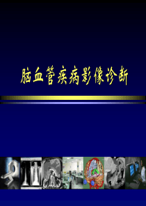 精品推荐医学影像诊断PPT课件图文详解完整版-脑血管疾病MRI诊断