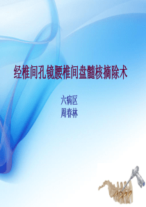 椎间孔镜